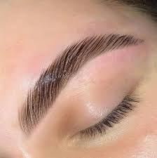Brow result 2